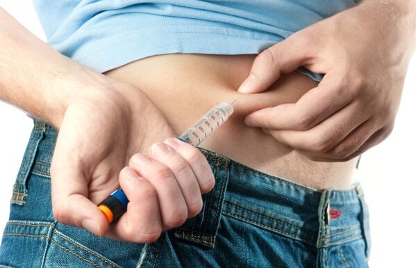 Teški dijabetes tipa 2 zahtijeva primjenu inzulina
